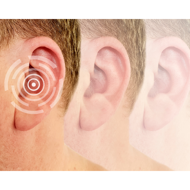 Vestibulocochlearis – 8. kranienerve